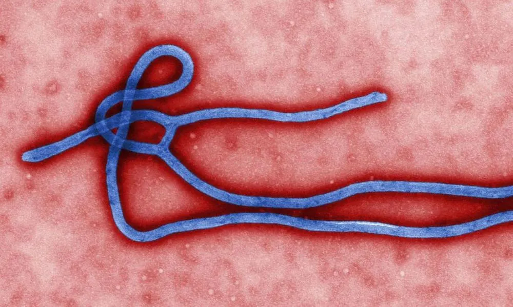 Vírus do Ebola - Foto: microbiologist Cynthia Goldsmith Internacional